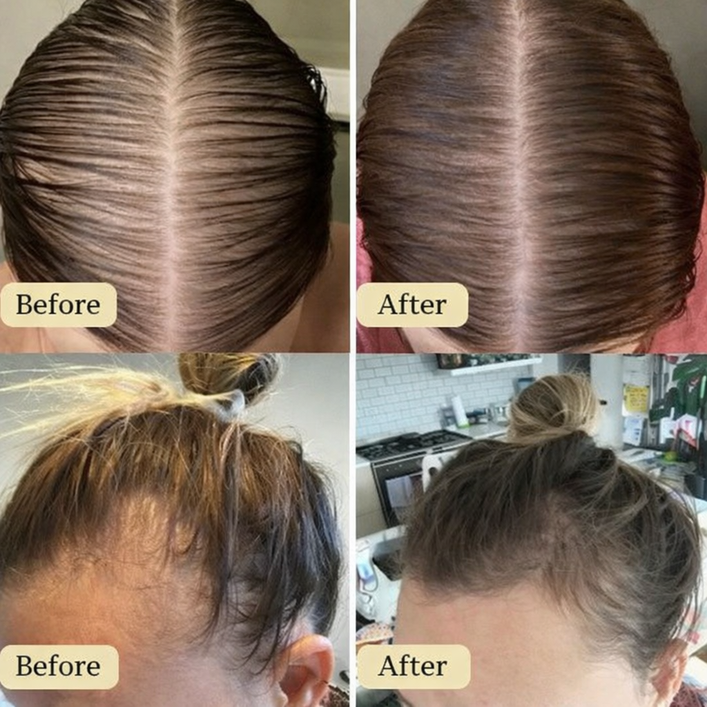 Carvenchy: Your natural oil treatment for hair growth.