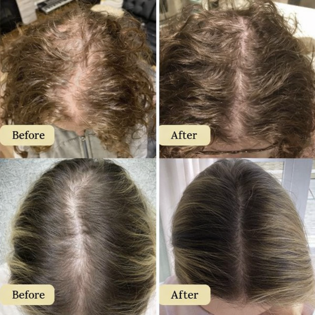 Carvenchy: Your natural oil treatment for hair growth.