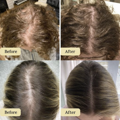 Carvenchy: Your natural oil treatment for hair growth.